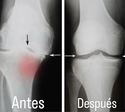 FLEXIKNEE PRO- TERAPIA PARA TUS RODILLAS SIN NECESIDAD DE MEDICAMETOS.