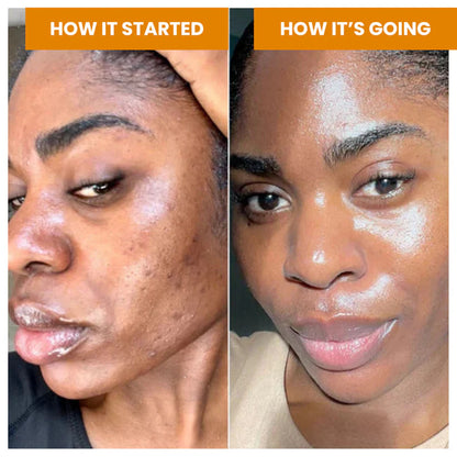 Jabón iluminador de cúrcuma (pocas existencias)