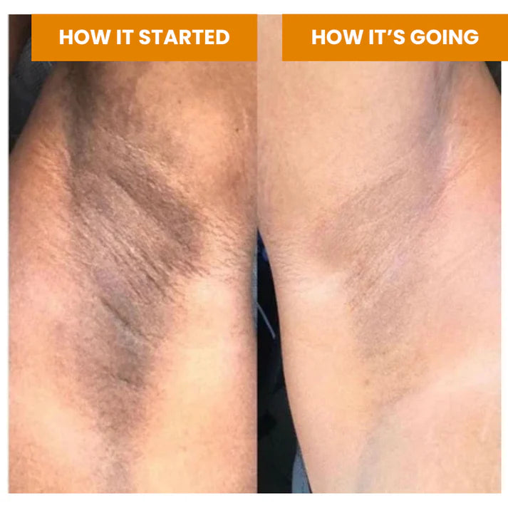 Jabón iluminador de cúrcuma (pocas existencias)